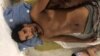 La salud de Luis Manuel Otero Alcántara se deteriora tras seis días de huelga de hambre y sed. (Facebook/MSI)